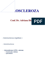 Ateroscleroza