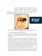 Diagnosis Banding Tonsilitis