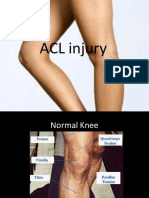 Understanding ACL injuries: Causes, symptoms, diagnosis and treatment options