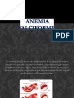 ANEMIA FALCIFORME.pptx