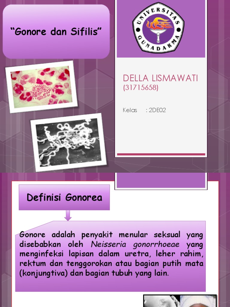 Gonore Dan Sifilis PPT Della PDF