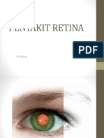 Penyakit Retina