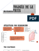 Fisiopatología de La Atelectasia