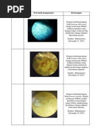 Katta klitorisli eski lezbiyenlarning porno video