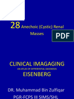Anechoic Renal Masses: Differential Diagnosis and Imaging Findings