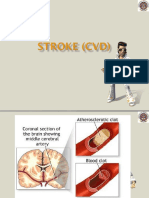 stroke-cvd.ppt