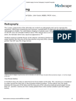 Clubfoot Imaging - Overview, Radiography, Computed Tomography
