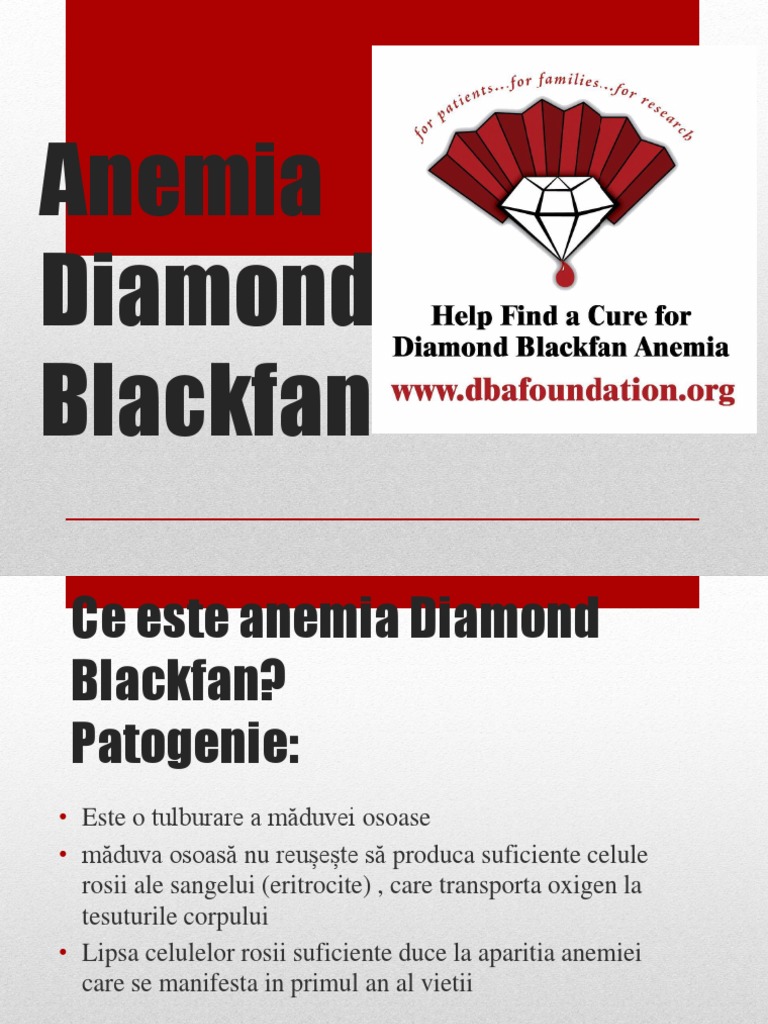 Anemia Diamond Blackfan