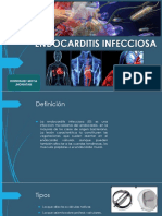 Endocarditis Infecciosa