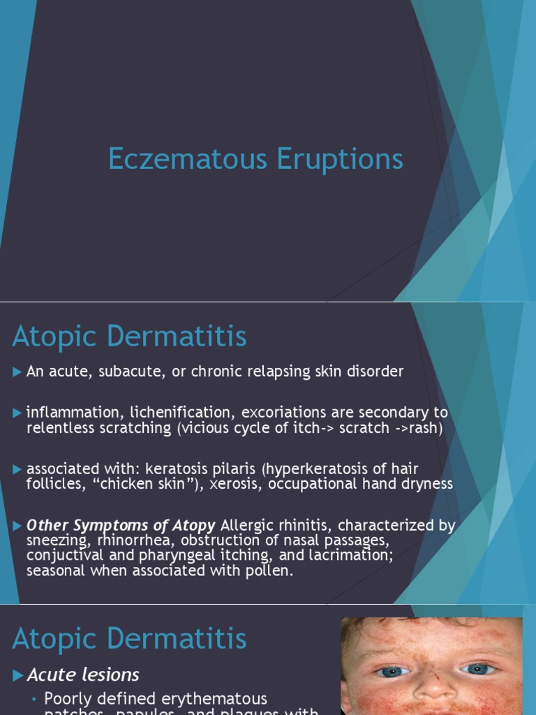 Which Clinical Manifestation Is Characterized by Eczematous Eruption-Dermatology Guide