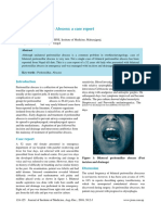 Bilateral Peritonsillar Abscess Case Report