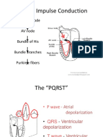 Normal Impulse Conduction: Sinoatrial Node AV Node Bundle of His Bundle Branches Purkinje Fibers