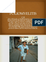 Poliomyelitis