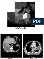 Gambar CT Scan
