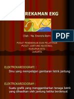 Perekaman EKG 2