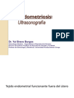 Endometriosis Tomonorte