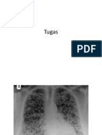 Tugas Radiologi
