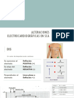 Alteraciones electrocardiográficas en SCA.pptx