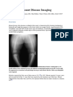 Blount Disease Imaging