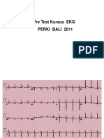 EKG Pre Test Kursus PERKI BALI 2011