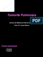 Tumorile Pulmonare: Centrul de Medicina Interna Fundeni Conf. Dr. Laura Iliescu