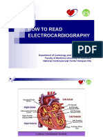 How To Read Ecg