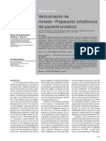 verticalizacion_de_molares-preparacion_ortodoncica_del_paciente_protesico.pdf;filename= UTF-8''verticalizacion de molares-preparacion ortodoncica del paciente protesico.pdf