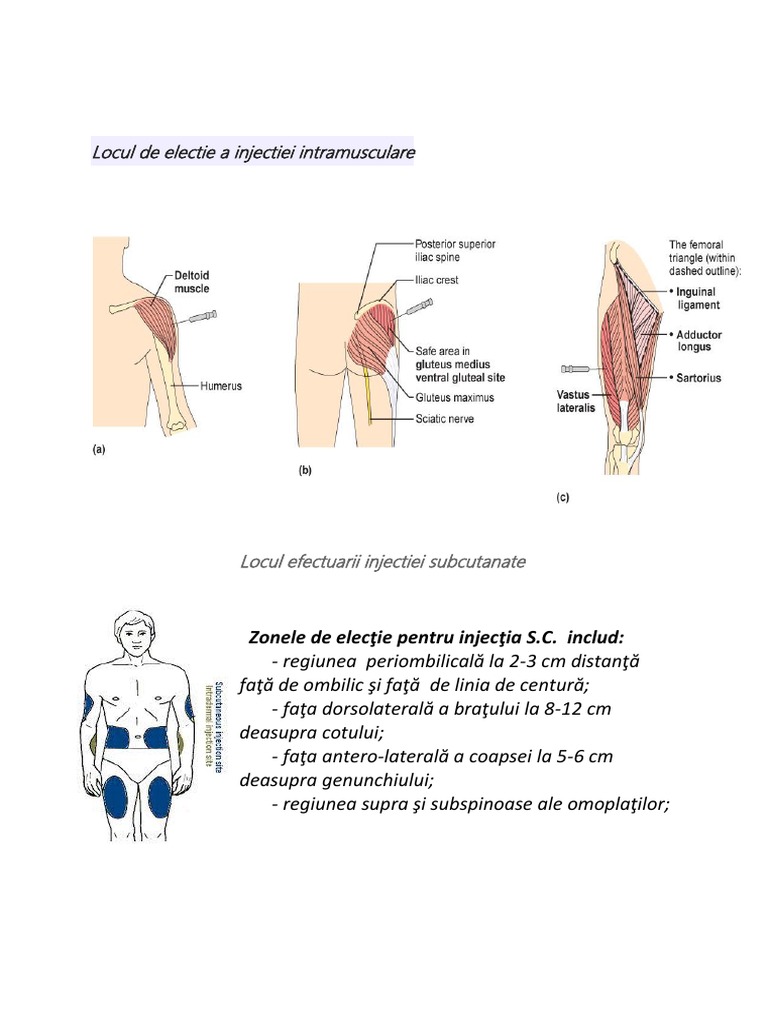 Locuri Electie Injectia Intramusculara