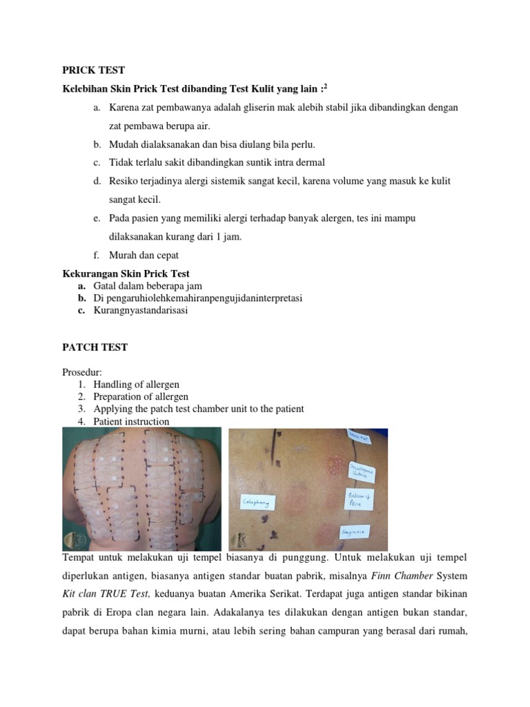 Prick Dan Patch Test | PDF