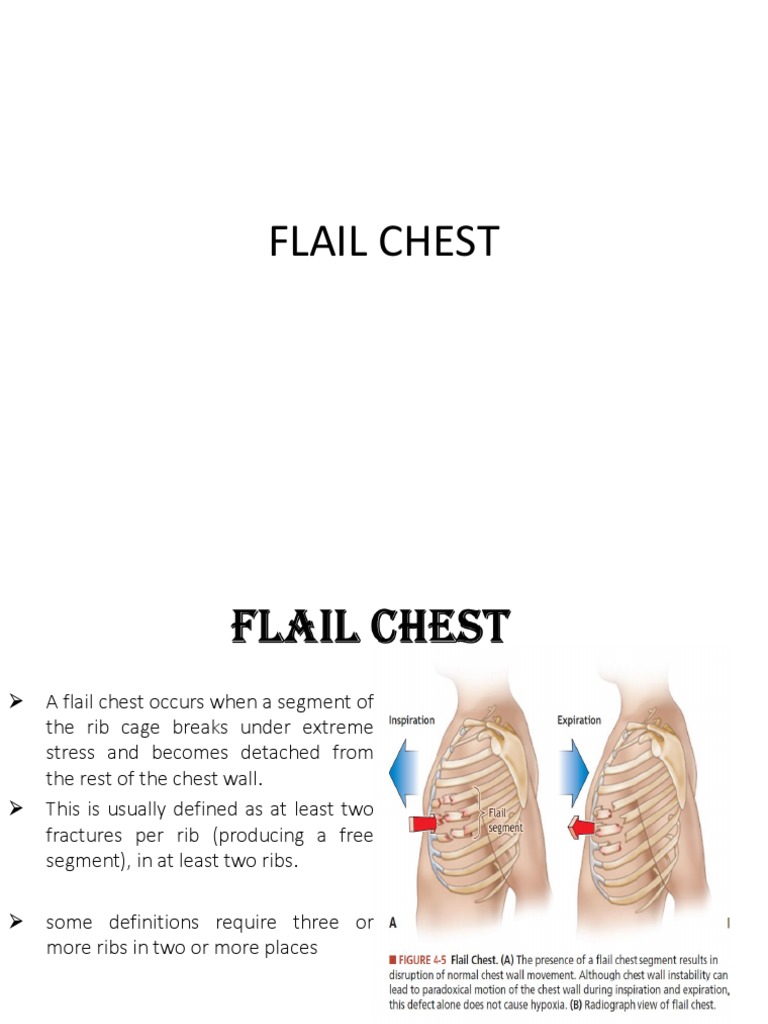 Flail Chest PDF Medical Emergencies Pulmonology