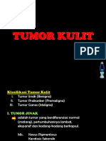 Tumor Kulit