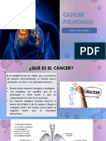 Cancer Pulmonar 
