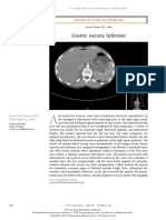 Gastric Ascaris Infection.pdf