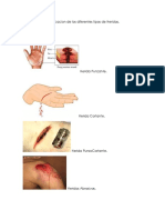 Clasificacion de Los Diferentes Tipos de Heridas