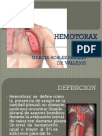 Hemotorax Pam