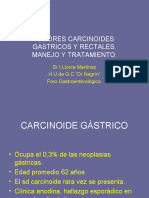 Tumores Carcinoides