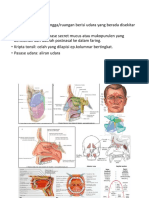 Sinusitis