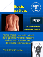 Escoliosis