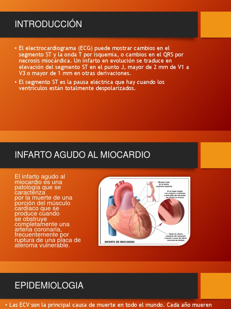 Infarto Agudo Al Miocardiosubir | PDF | Trombo | Infarto de miocardio