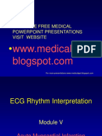ECG Rhythm Interpretation Module V