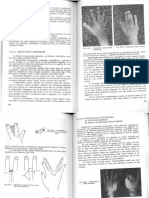 Tratat de Patologie Chirurgicala. Vol III E. Proca - PAG 404-SFARSIT