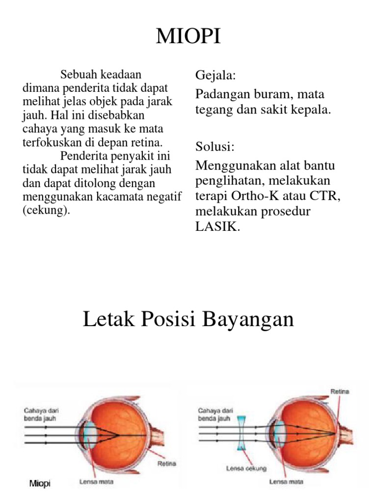 ads for my site - Kesimpulan