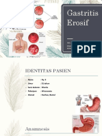 Gastritis Erosif