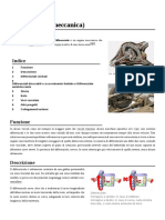 Differenziale (Meccanica)