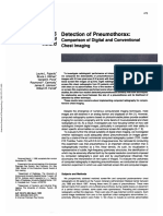 Detection of Pneumothorax:: 1988 ARRS Executive Council Award