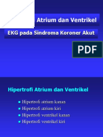 EKG_NSTEI_ANTEKSTENSIF