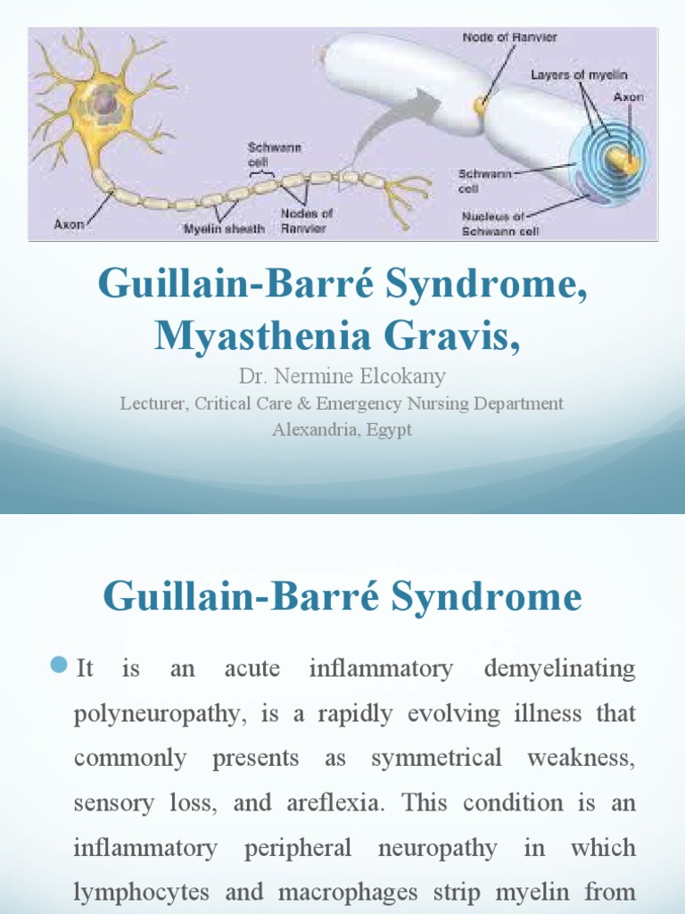 Guillain-Barré Syndrome, Myasthenia Gravis,: Dr. Nermine Elcokany | PDF ...