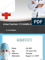 Close Fracture 1/3 Middle Left Femur