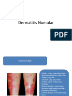 Dermatitis Numular Skenario 3 BLK 13