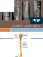 Radiologi Tumor Tulang